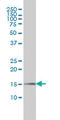 Peptidylprolyl Cis/Trans Isomerase, NIMA-Interacting 1 antibody, LS-C197907, Lifespan Biosciences, Western Blot image 