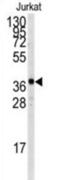 TAL BHLH Transcription Factor 1, Erythroid Differentiation Factor antibody, abx031689, Abbexa, Western Blot image 
