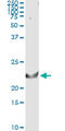 TNF Superfamily Member 14 antibody, LS-C133566, Lifespan Biosciences, Immunoprecipitation image 