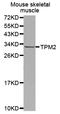 Tropomyosin 2 antibody, A03082, Boster Biological Technology, Western Blot image 