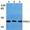FOS Like 2, AP-1 Transcription Factor Subunit antibody, GTX49376, GeneTex, Western Blot image 