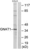 G Protein Subunit Alpha Transducin 1 antibody, GTX87657, GeneTex, Western Blot image 