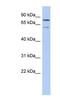 Oxidative Stress Induced Growth Inhibitor 1 antibody, NBP1-59296, Novus Biologicals, Western Blot image 