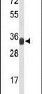 Ribosomal Protein L5 antibody, PA5-26269, Invitrogen Antibodies, Western Blot image 