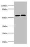 Cytochrome P450 Family 2 Subfamily E Member 1 antibody, A50177-100, Epigentek, Western Blot image 
