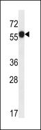 Acidic Residue Methyltransferase 1 antibody, LS-C168178, Lifespan Biosciences, Western Blot image 