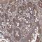 Transmembrane Protein 139 antibody, HPA036983, Atlas Antibodies, Immunohistochemistry paraffin image 