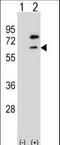 Zinc Finger And BTB Domain Containing 7B antibody, LS-C160729, Lifespan Biosciences, Western Blot image 