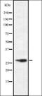 Free Fatty Acid Receptor 1 antibody, orb337068, Biorbyt, Western Blot image 