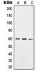 Sorting Nexin 4 antibody, LS-C353089, Lifespan Biosciences, Western Blot image 