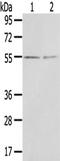 Chordin Like 1 antibody, TA351901, Origene, Western Blot image 