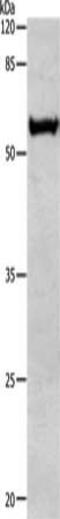 Aldehyde Dehydrogenase 1 Family Member A1 antibody, CSB-PA729886, Cusabio, Western Blot image 