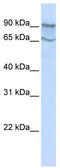 Mitogen-Activated Protein Kinase Kinase Kinase Kinase 2 antibody, TA346723, Origene, Western Blot image 