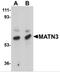 Matrilin 3 antibody, 5141, ProSci Inc, Western Blot image 