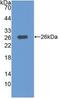 Mitogen-Activated Protein Kinase Kinase Kinase 1 antibody, MBS2026504, MyBioSource, Western Blot image 