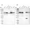Phosphatidylinositol Binding Clathrin Assembly Protein antibody, NBP1-86658, Novus Biologicals, Western Blot image 