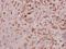 Interleukin 11 antibody, GTX66720, GeneTex, Immunohistochemistry paraffin image 