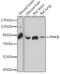 Phosphatidylinositol 4-Kinase Beta antibody, 16-595, ProSci, Western Blot image 