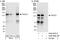 Transforming Acidic Coiled-Coil Containing Protein 3 antibody, A302-588A, Bethyl Labs, Western Blot image 