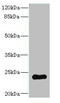 Regulator Of G Protein Signaling 2 antibody, A56997-100, Epigentek, Western Blot image 