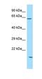 Sosondowah Ankyrin Repeat Domain Family Member C antibody, orb326652, Biorbyt, Western Blot image 