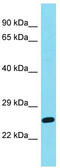 DIRAS Family GTPase 2 antibody, TA335541, Origene, Western Blot image 