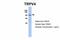 Transient Receptor Potential Cation Channel Subfamily V Member 4 antibody, PA5-41066, Invitrogen Antibodies, Western Blot image 