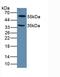 Lysyl Oxidase Like 1 antibody, LS-C295238, Lifespan Biosciences, Western Blot image 