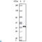 Protein S100-A6 antibody, LS-C812409, Lifespan Biosciences, Immunohistochemistry paraffin image 