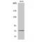 Slingshot Protein Phosphatase 3 antibody, LS-C386194, Lifespan Biosciences, Western Blot image 