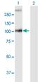 Glucosylceramidase Beta 2 antibody, H00057704-B01P, Novus Biologicals, Western Blot image 