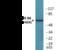 Ribosomal Protein S6 Kinase B1 antibody, EKC2489, Boster Biological Technology, Western Blot image 