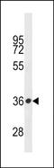 Serine Protease 57 antibody, PA5-49256, Invitrogen Antibodies, Western Blot image 