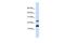 Basic Leucine Zipper ATF-Like Transcription Factor antibody, GTX44666, GeneTex, Western Blot image 