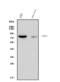 Protein Kinase C Theta antibody, A01293-3, Boster Biological Technology, Western Blot image 