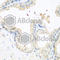Matrix Metallopeptidase 14 antibody, A2549, ABclonal Technology, Immunohistochemistry paraffin image 