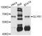 Glyoxylate Reductase 1 Homolog antibody, STJ111541, St John