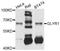 Glyoxylate Reductase 1 Homolog antibody, STJ111541, St John