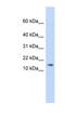 Adipogenesis Associated Mth938 Domain Containing antibody, NBP1-56786, Novus Biologicals, Western Blot image 