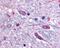 Solute Carrier Family 5 Member 3 antibody, 48-173, ProSci, Immunohistochemistry paraffin image 