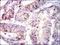 PBK/TOPK antibody, NBP2-37514, Novus Biologicals, Immunohistochemistry paraffin image 