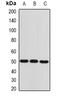 Alpha-Methylacyl-CoA Racemase antibody, orb377916, Biorbyt, Western Blot image 