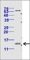 Eukaryotic Translation Initiation Factor 4E Binding Protein 1 antibody, orb183352, Biorbyt, Western Blot image 