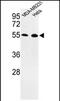 Egl-9 Family Hypoxia Inducible Factor 2 antibody, PA5-72559, Invitrogen Antibodies, Western Blot image 
