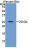 CD6 Molecule antibody, LS-C314668, Lifespan Biosciences, Western Blot image 