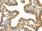 Interleukin 3 Receptor Subunit Alpha antibody, CSB-PA925610, Cusabio, Immunohistochemistry paraffin image 