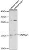 DnaJ Heat Shock Protein Family (Hsp40) Member C24 antibody, LS-C750531, Lifespan Biosciences, Western Blot image 