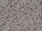 Myogenic Differentiation 1 antibody, NBP2-77430, Novus Biologicals, Immunohistochemistry paraffin image 