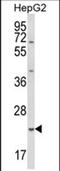 Glutathione S-Transferase Alpha 4 antibody, PA5-72606, Invitrogen Antibodies, Western Blot image 