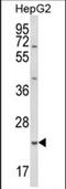 Glutathione S-transferase 5.7 antibody, PA5-72606, Invitrogen Antibodies, Western Blot image 